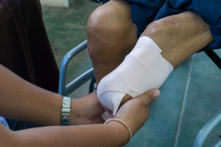 Amputation-Injury
